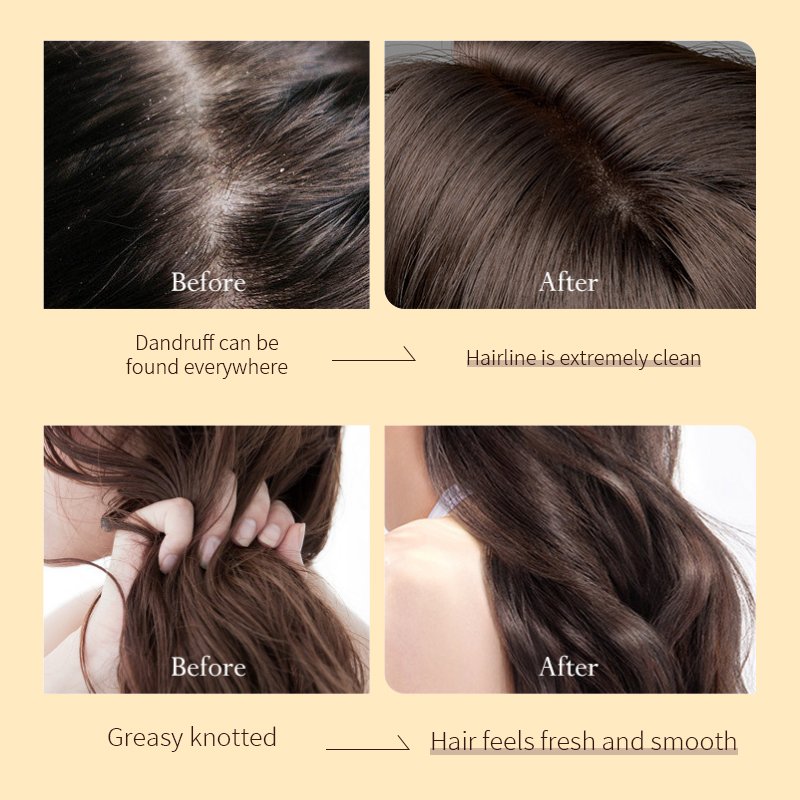 Private Label Biotin Anti Loss Fall Shampoo Organic Hair Growth Shampoo And Conditioner