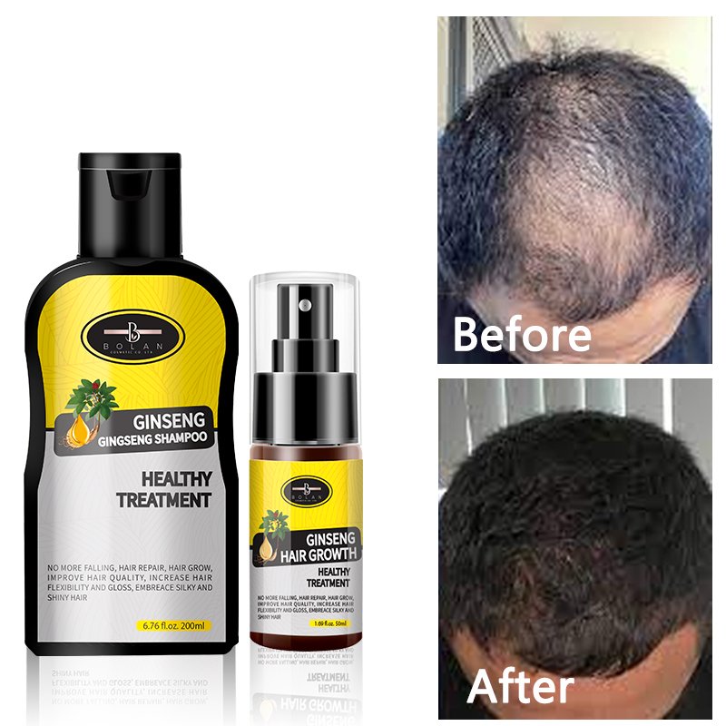 Buy Best Solutions Tonic Anti Loss Treatment Own Label Strong Products Shampoo And Spray set For Hair Regrowth Treatments