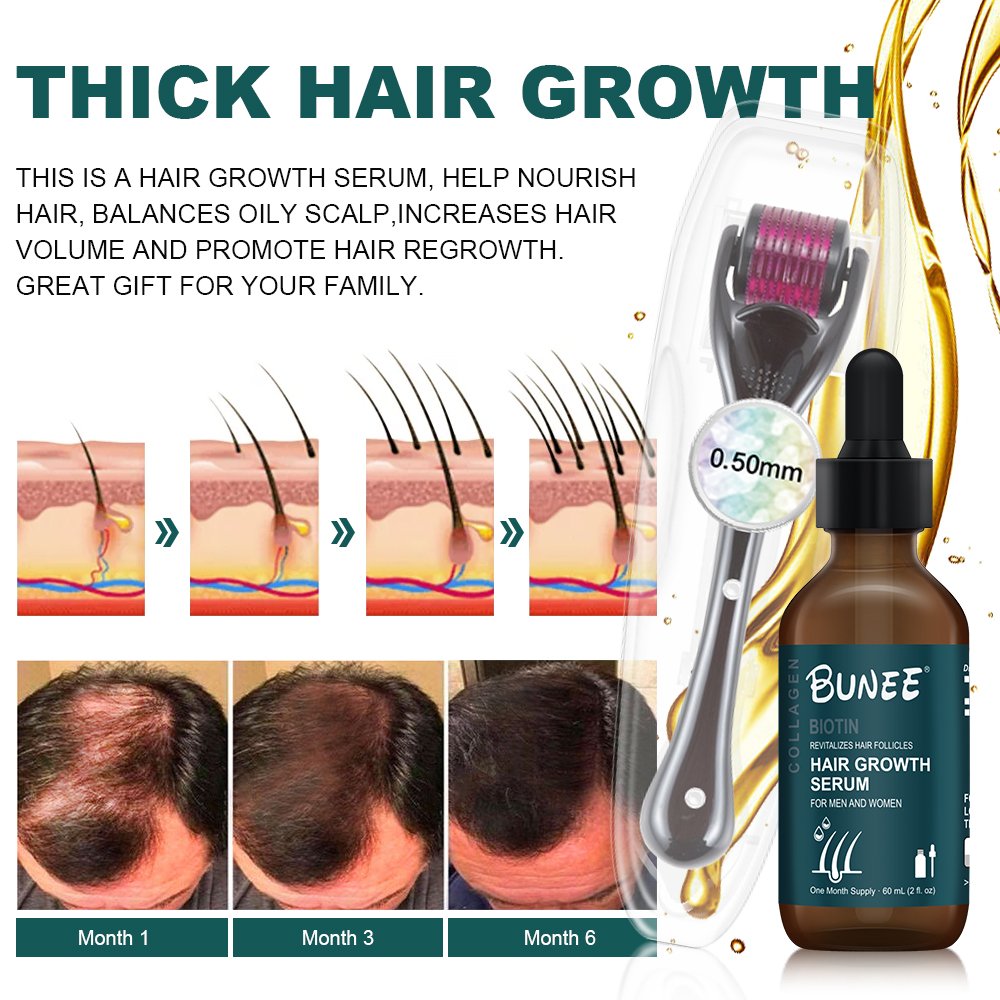High Quality Herbal Hair Loss Treatment Fast Hair Growth Serum Biotin Hair Restoration Regrowth Camellia Oil