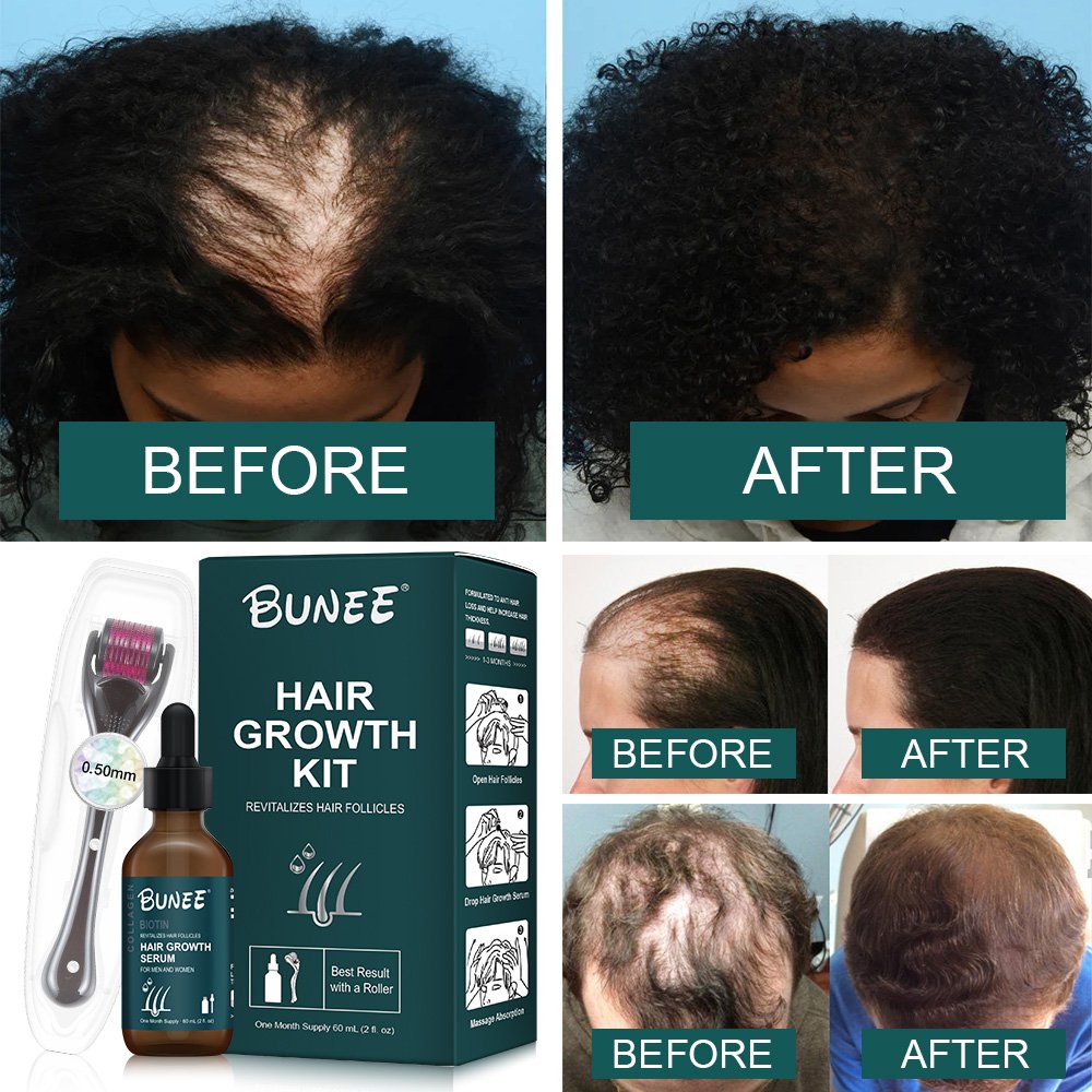 High Quality Herbal Hair Loss Treatment Fast Hair Growth Serum Biotin Hair Restoration Regrowth Camellia Oil