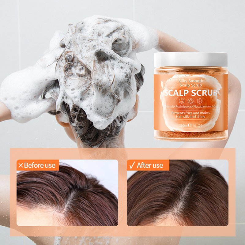 Private Label Micro-Exfoliating Shampoo Scalp Scrub Treatment to Soothe a Dry Flaky Itchy scalp shampoo