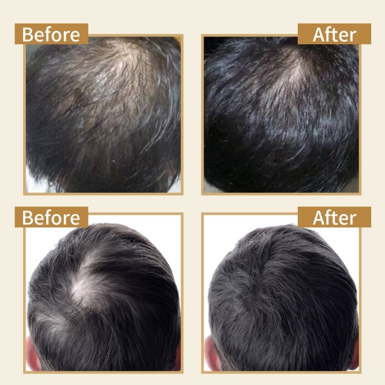 Organic Herbal Extracts Hair Tonic with Ginger Essence Natural Conditioner Hair Loss Prevention Repair Damaged Hair Treatment