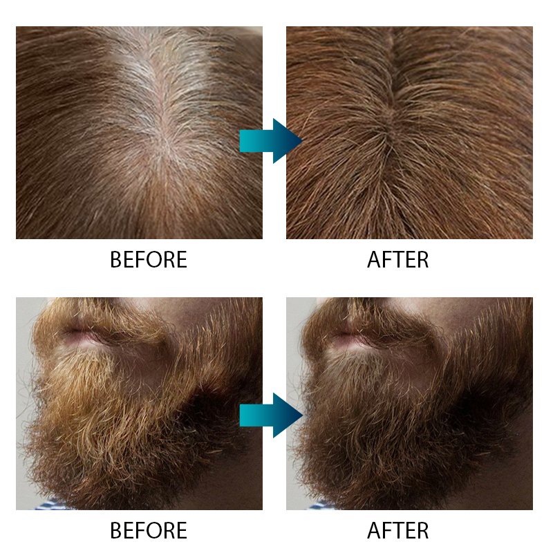 Lanthome White To Black Naturally Regrow Care Growth Keratin Hair Spray Tonic