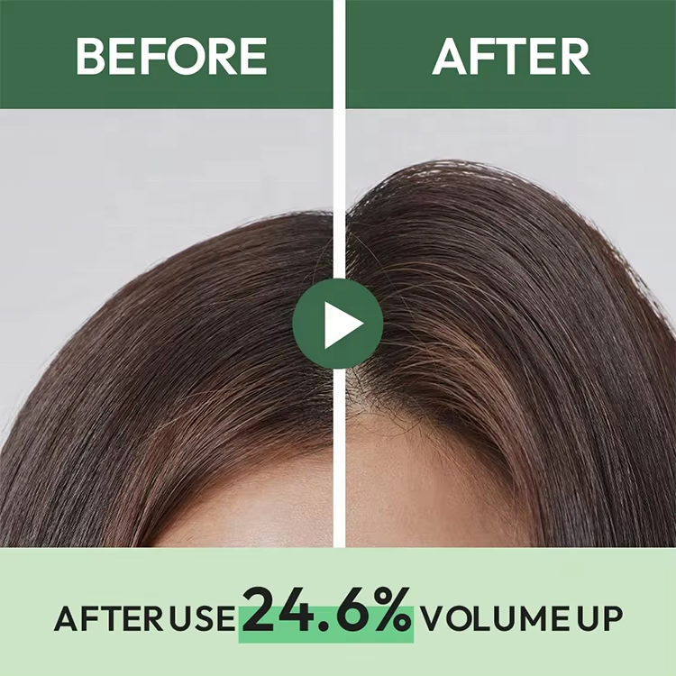 Tea Tree Shampoo Anti Dandruff Itching Scalp Hair Loss Treatment Natural Salon Hair Care Shampoo