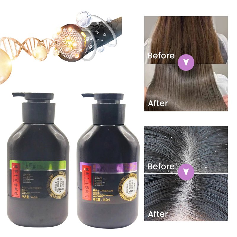 100% Organic Hair Care Shampoo Private Label Wholesale Price High Quality Anti-dandruff Shampoo