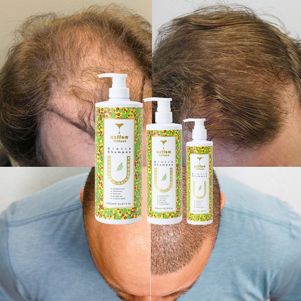 Manufacturer biotin hair growth anti-hair loss hydrating smooth moister shampoo with batana oil