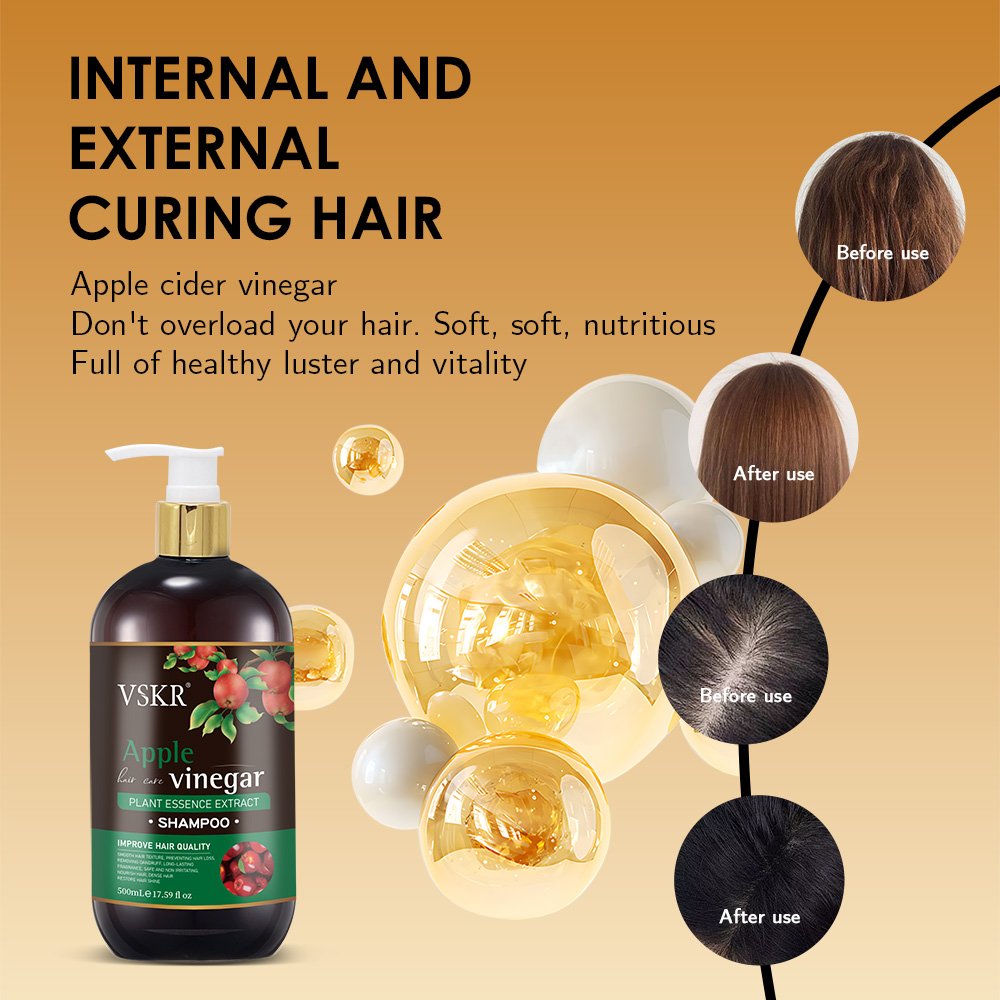 OEM ODM Natural Apple Cider Vinegar Shampoo for Men and Womens Hair Growth Thinning Hair & Loss