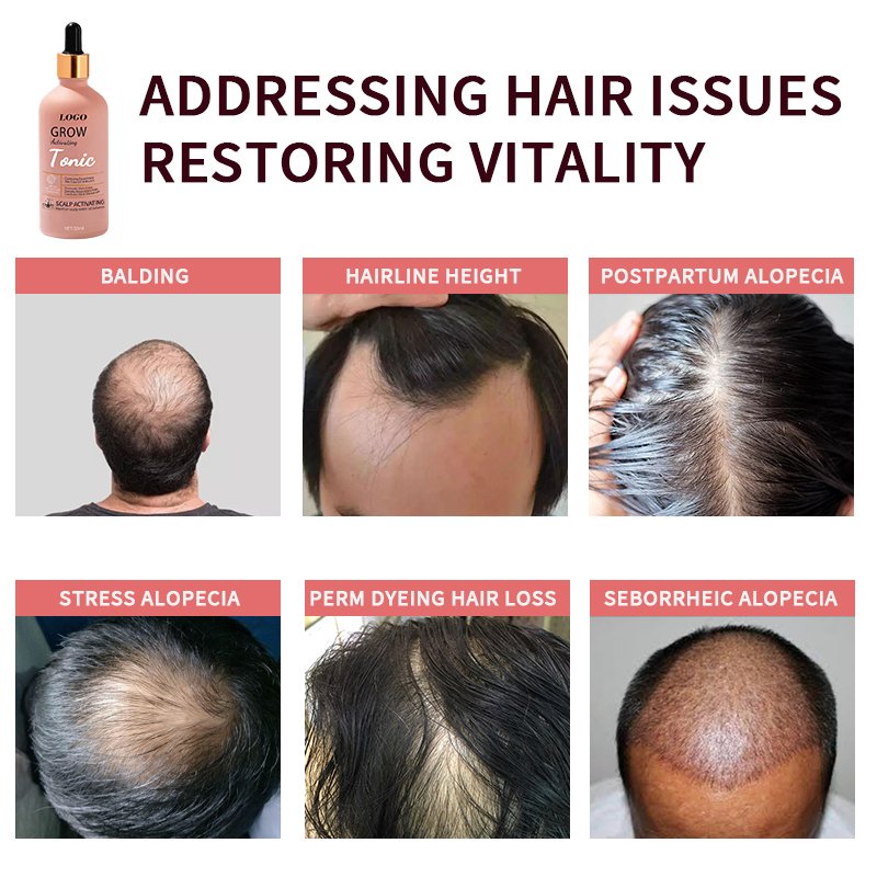 Rosemary and biotin extraction Repair damage caused by hot dyeing products that made hair rapid grows tonic hair oil to grow