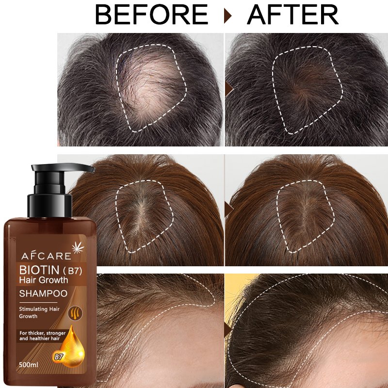 Private Label Guangzhou Hair Growth Shampoo Anti Hair Loss Create Own Keratin Shampoo and Conditioner
