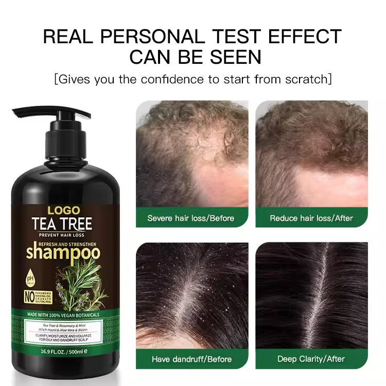 Mens Women's Shampoo Anti Dandruff Organic Natural Anti-Lice Damage Anti Hair Loss Treatment Shampoo With Tea Trea