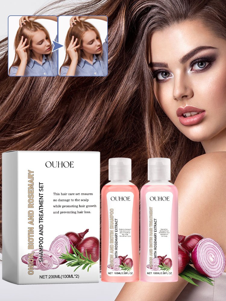 Factory OEM Wholesale Natural Organic Onion Biotin Rosemary Shampoo Treatment For Damaged Repair Stronger Hair Growth Shampoo