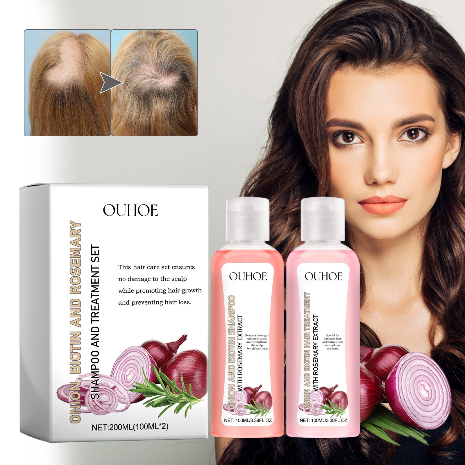Factory OEM Wholesale Natural Organic Onion Biotin Rosemary Shampoo Treatment For Damaged Repair Stronger Hair Growth Shampoo