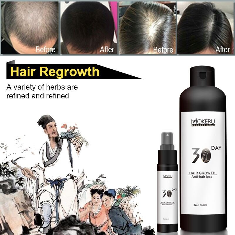 Best hair loss products to help rapid hair growth and prevent fall solution