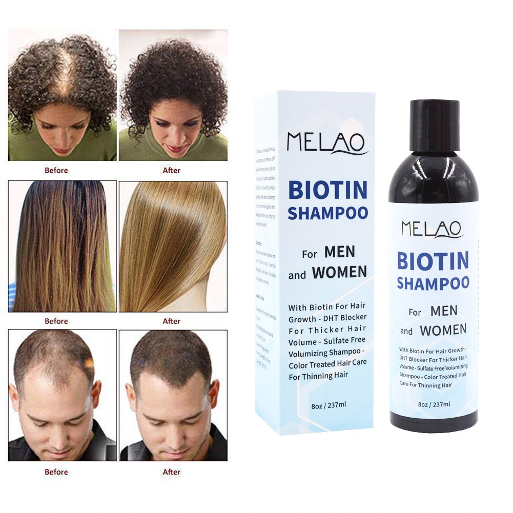 Private Label Thickening Biotin Hairloss Shampoo For Hair Growth Shampoo For Hair Loss All Natural Thinning Hair For Women Men
