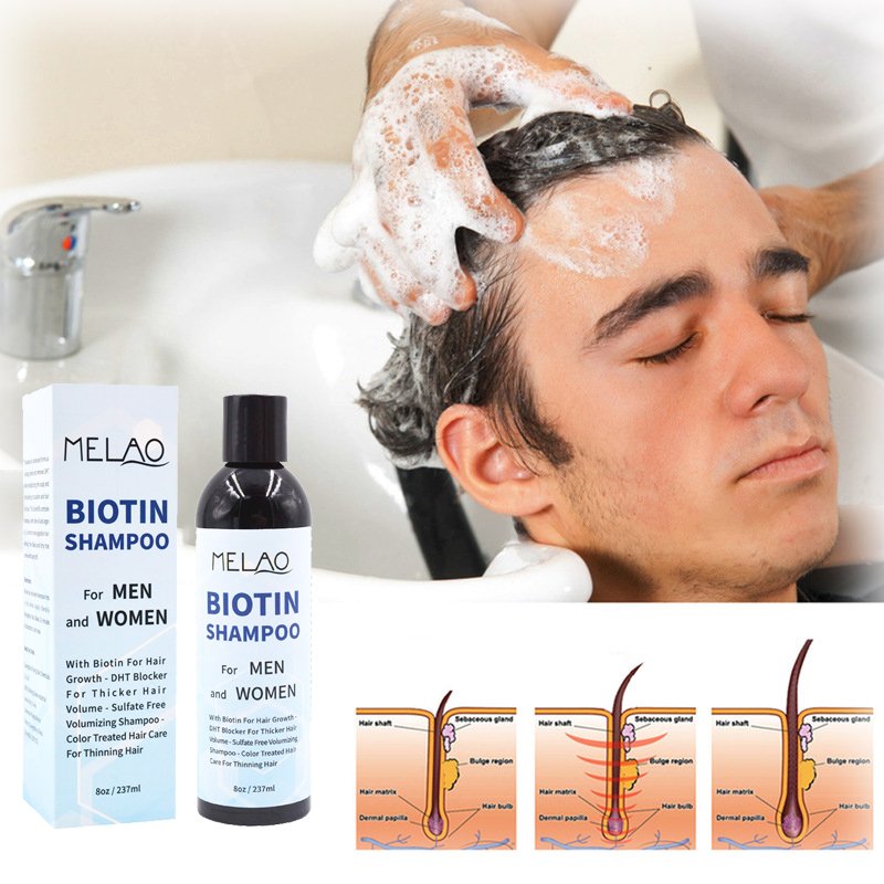 Private Label Thickening Biotin Hairloss Shampoo For Hair Growth Shampoo For Hair Loss All Natural Thinning Hair For Women Men