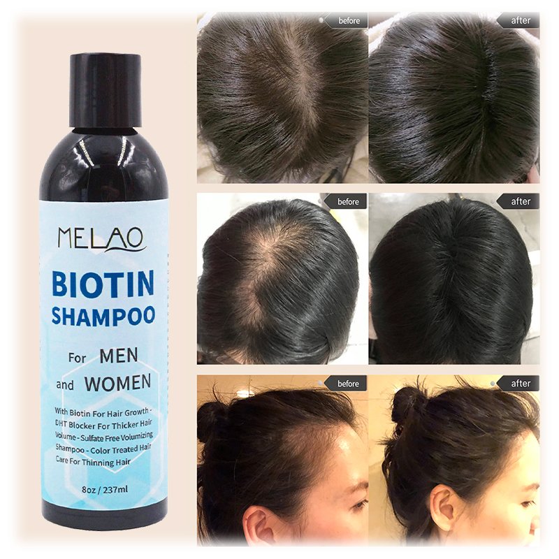 Private Label Thickening Biotin Hairloss Shampoo For Hair Growth Shampoo For Hair Loss All Natural Thinning Hair For Women Men