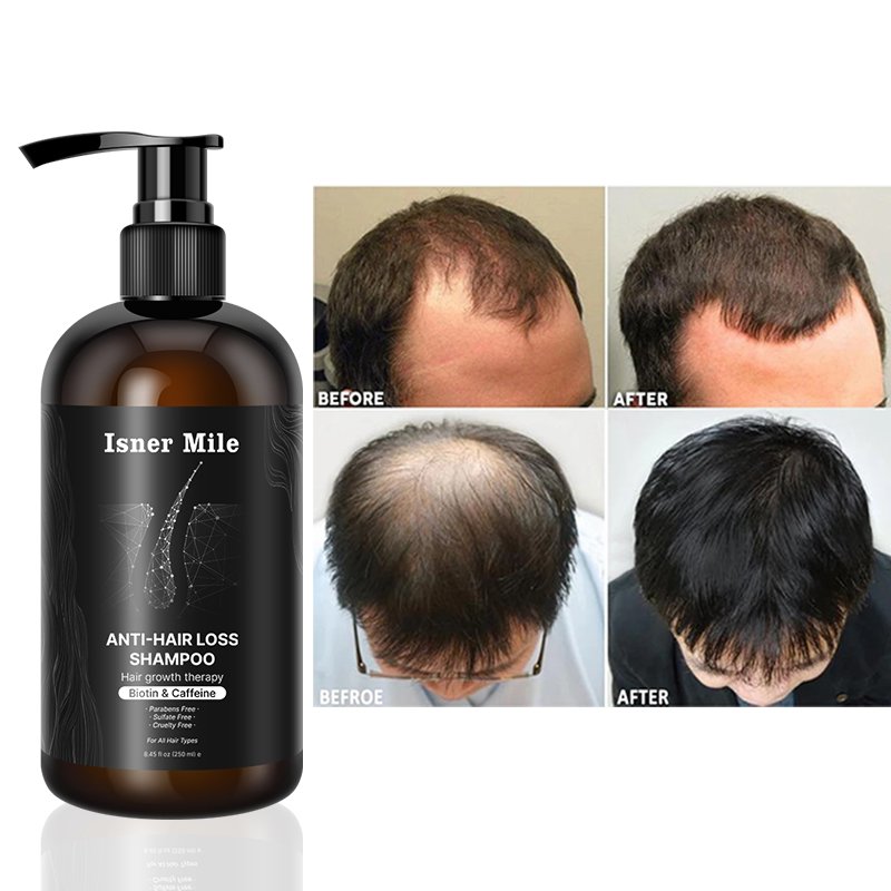 Natural care thicker hair biotin castor growth oil hair loss treatment hair growth shampoo