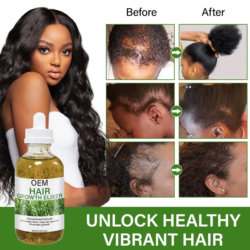 Rosemary Infusion Hair Fast Growth Oil Castor Peppermint Herbal Blend Elixir Anti Hair Loss Treatment Serum Scalp Tonic OEM
