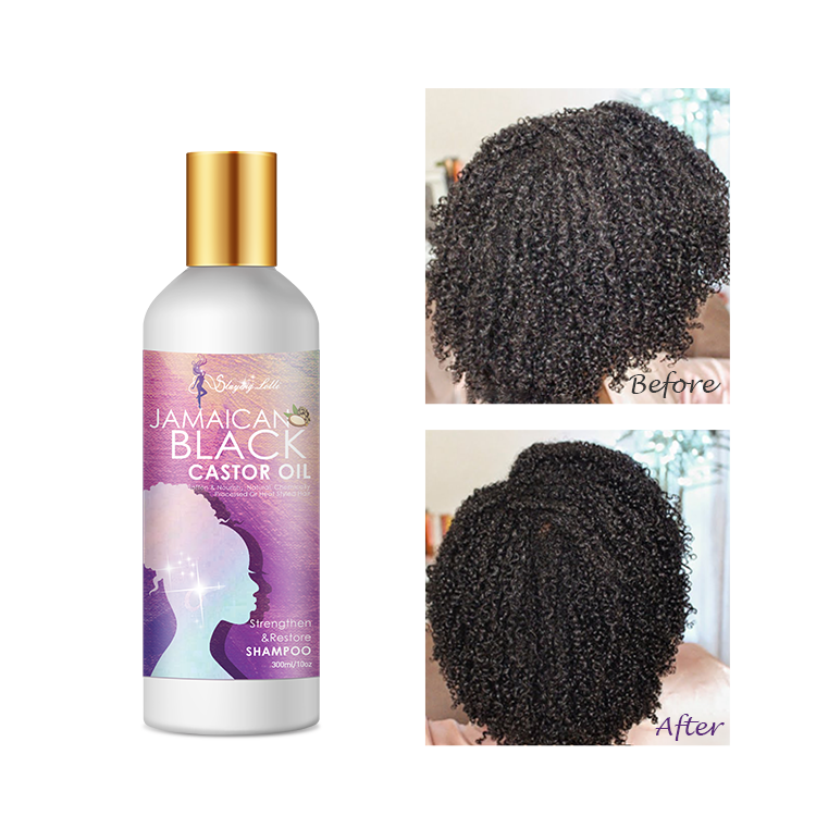 Factory Custom Logo and Packaging Reduces Hair Loss Organic Hair Growth Castor Oil Shampoo for All Hair Types