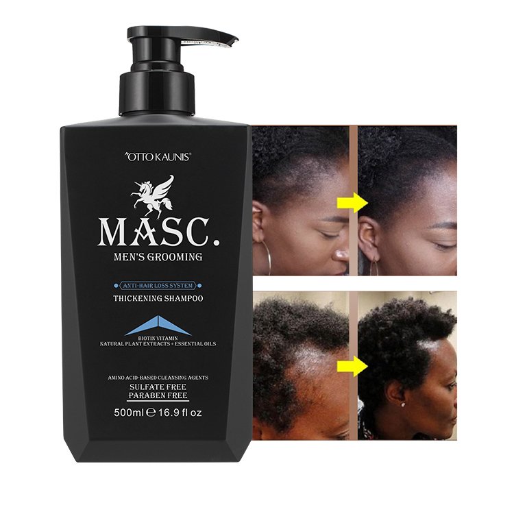 Make own brand natural ginger essence sulfate free anti loss men hair growth shampoo