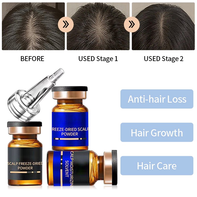 hair meso serum loss fall alopecia and growth treatment regrowth tonics hair grow therapy hair growth microneedling serum