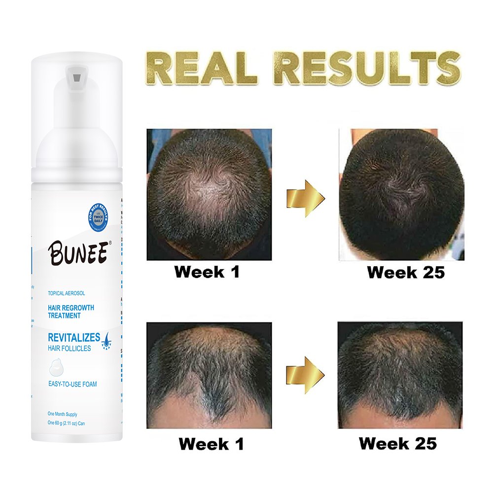 OEM Special Formula BUNEE 60ml hair regrowth tonics BIOTIN Vitamin hair growth foam Serum