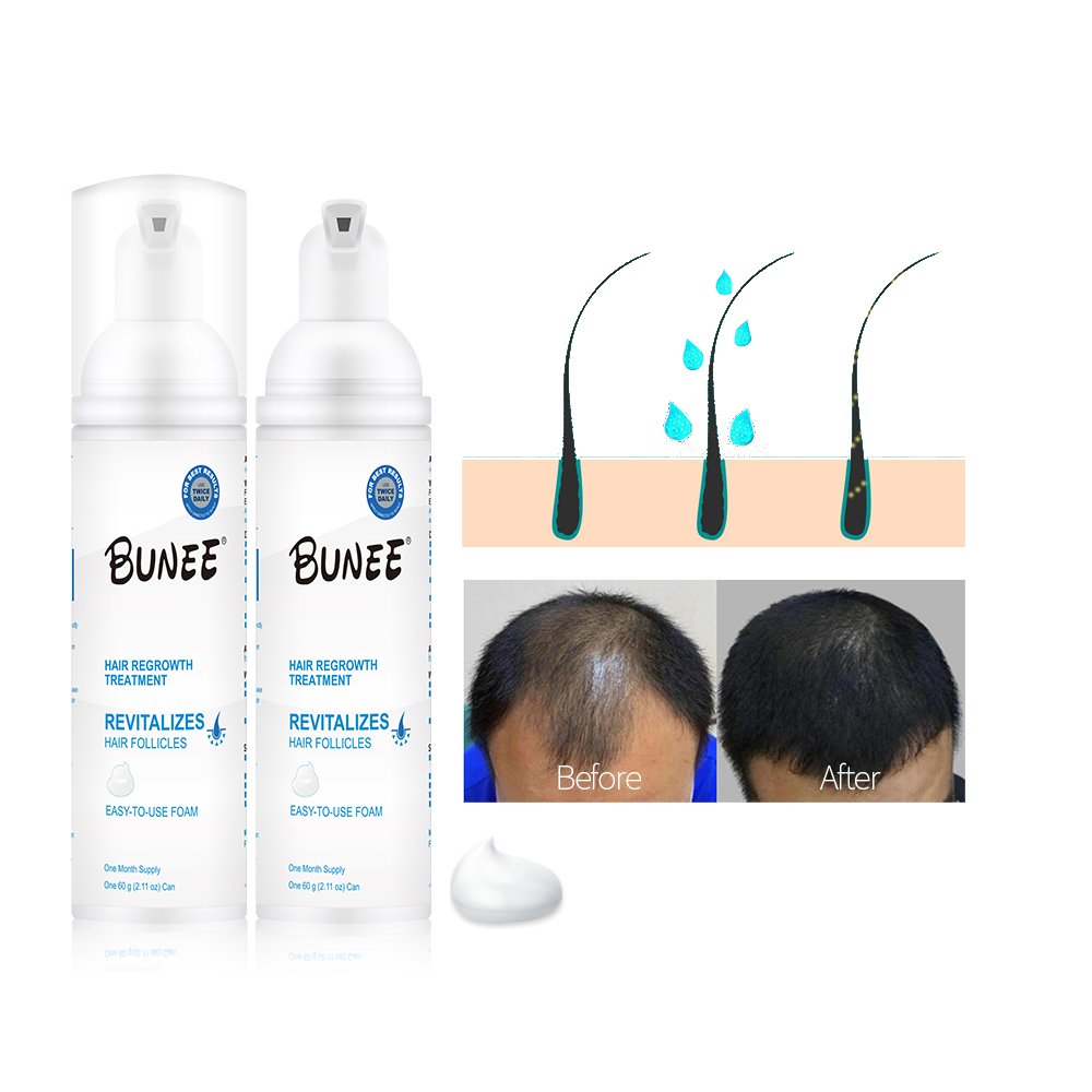 OEM Special Formula BUNEE 60ml hair regrowth tonics BIOTIN Vitamin hair growth foam Serum