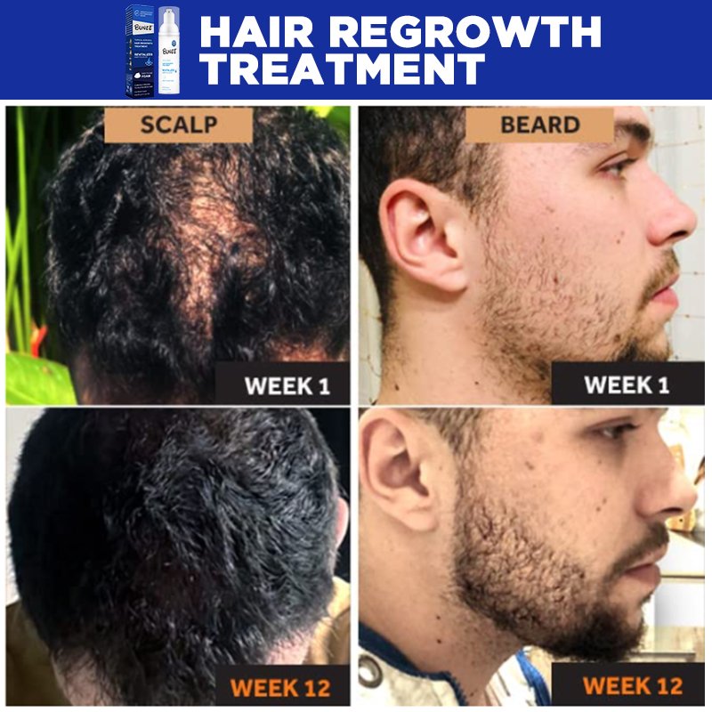 OEM Special Formula BUNEE 60ml hair regrowth tonics BIOTIN Vitamin hair growth foam Serum