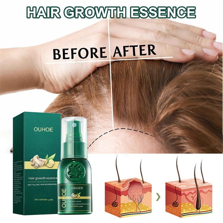 100% natural pure Hair Regrowth Treatment Anti Loss ginger Serum hair growth essence spray