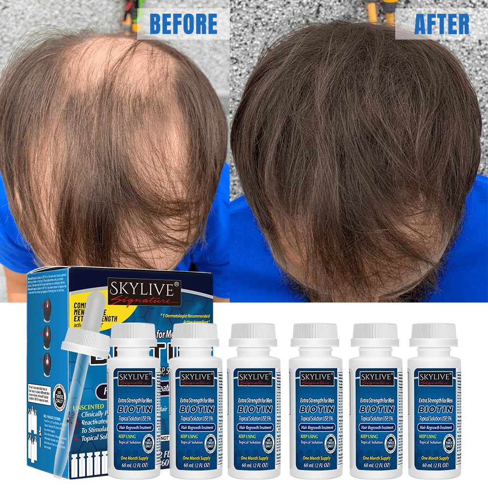 Custom Logo 60ML Kirland 5% Hair Growth Serum Kit Hair Regrowth Oil Hair Growth product Anti-Loss Treatment For Men