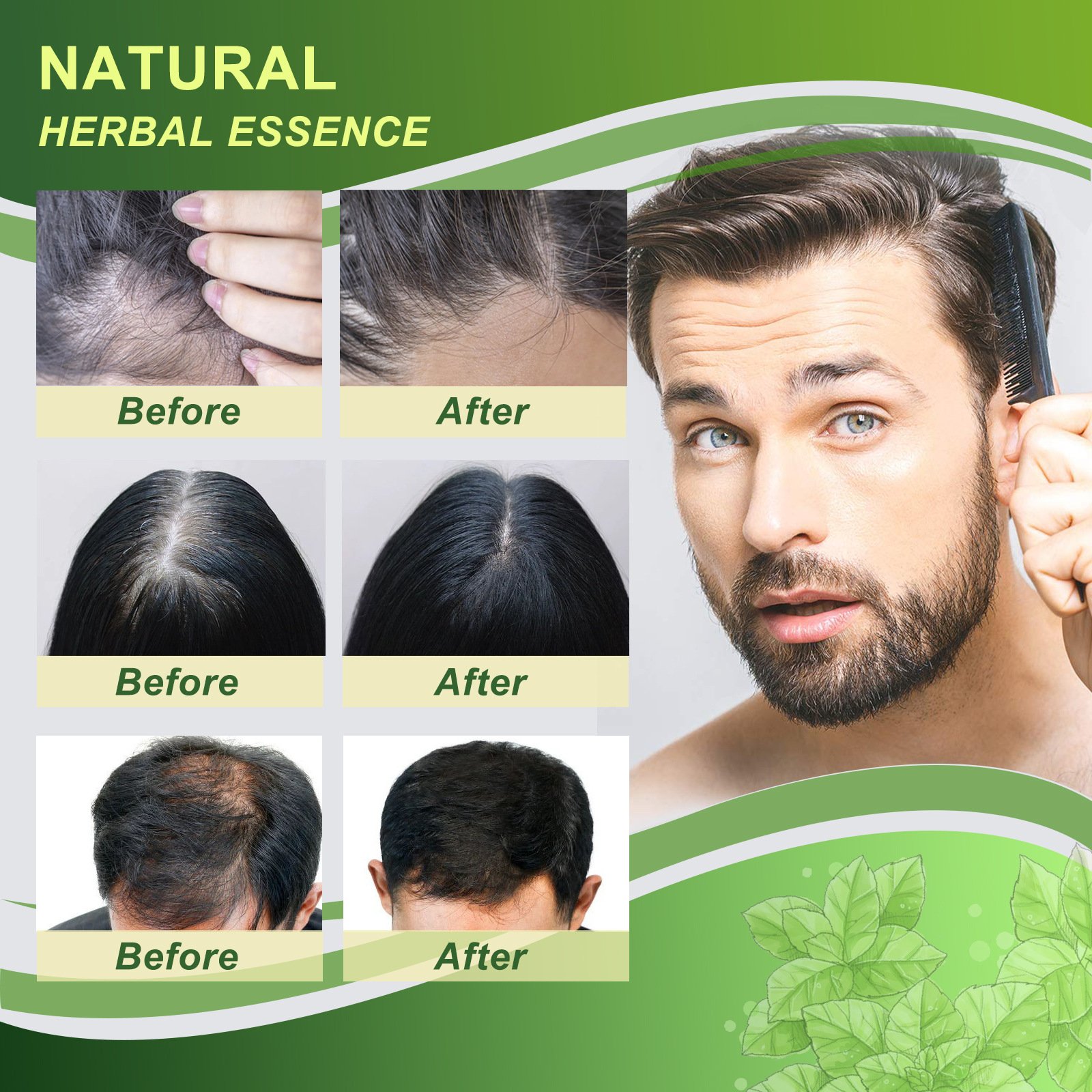 Wholesale Factory Price Organic Hair Loss Preventing Hair Care Kits Anti Itching Hair Regrowth Ginger Shampoo Conditioner