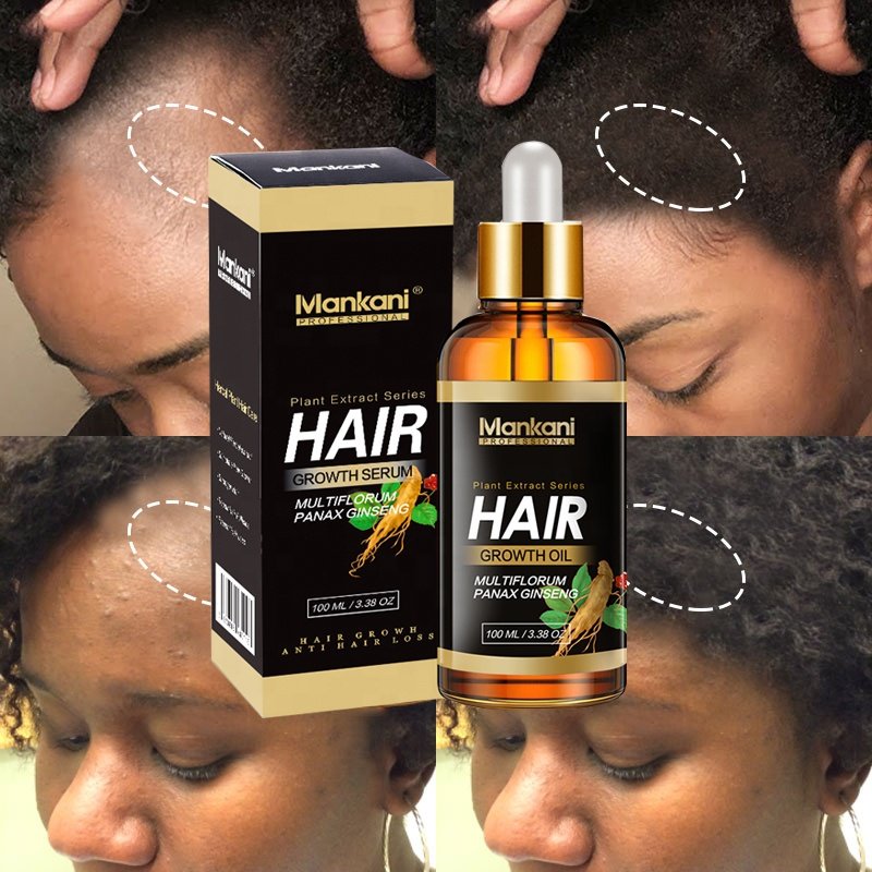 OEM Scalp Serum Vegan Hair Regrowth Treatment Growth Oil Private Label Organic Restoration Ginger Oil Personal Care Products