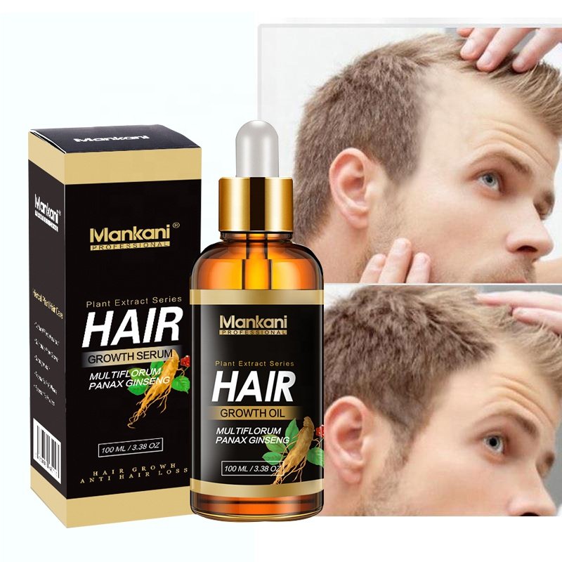OEM Scalp Serum Vegan Hair Regrowth Treatment Growth Oil Private Label Organic Restoration Ginger Oil Personal Care Products