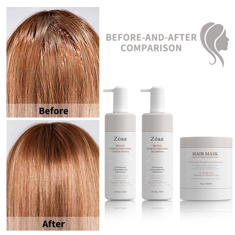 DIWEI Natural Anti Hair Loss Shampoo Biotin Hair Shampoo in bulk Ricinus Communis Seed Castor Oil Biotin Shampoo for hair growth