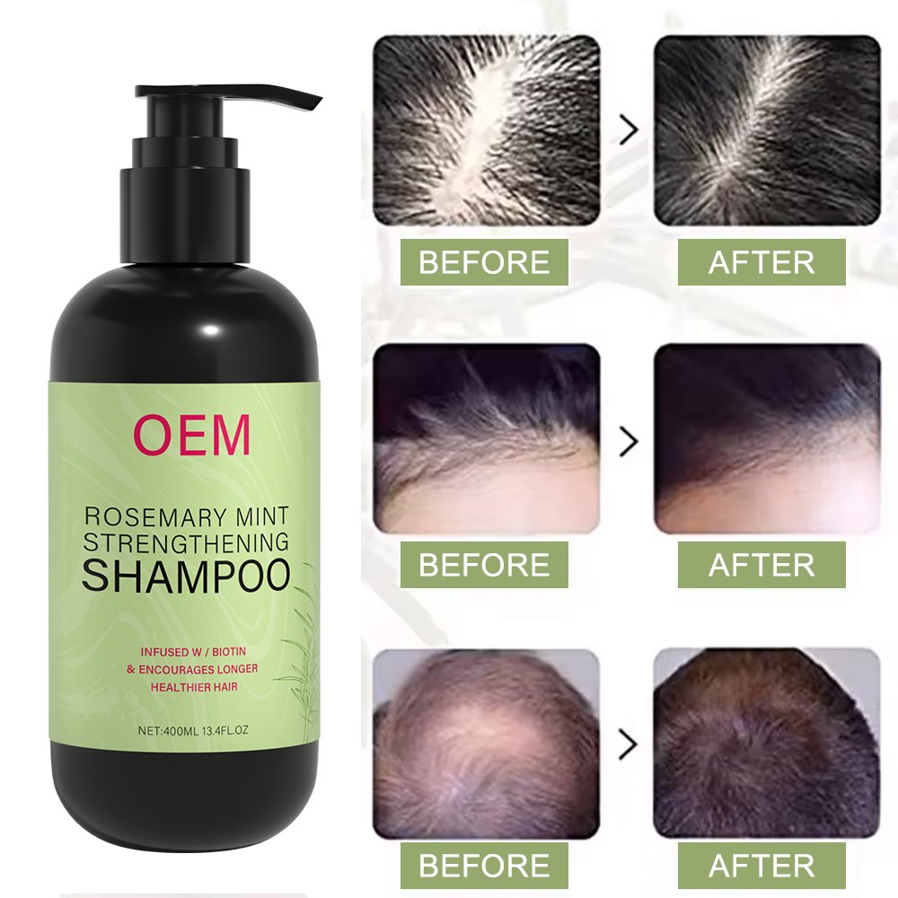 Rosemary Mint Strengthening Shampoo Infused With Bio OEM Scalp Alopecia Treatment Hair Growth Shampoo And Conditioner Kit
