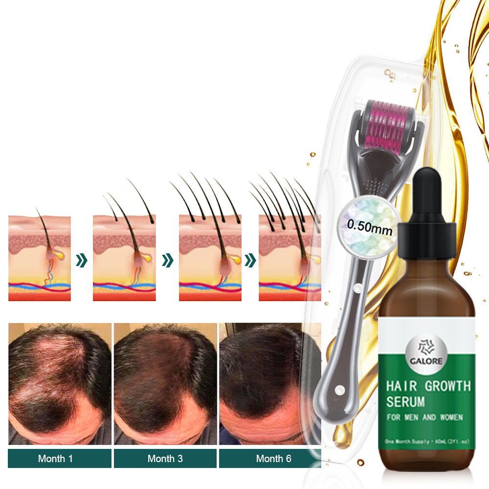 Private Label 100% Organic Hair Growth Oil For Loss Hair Sulphate Free Natural Hair Care Shampoo