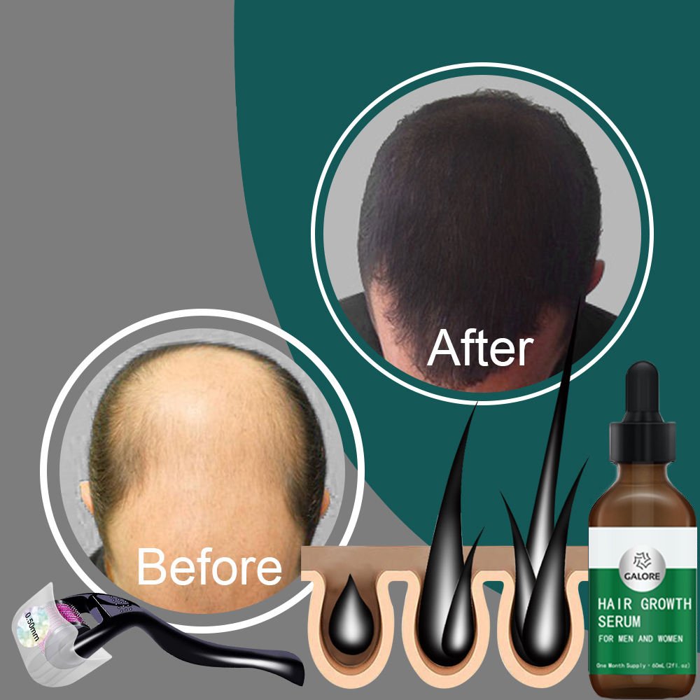 Private Label 100% Organic Hair Growth Oil For Loss Hair Sulphate Free Natural Hair Care Shampoo