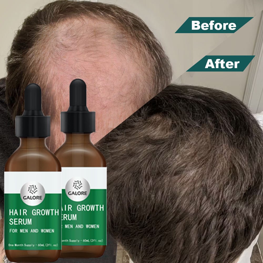 Private Label 100% Organic Hair Growth Oil For Loss Hair Sulphate Free Natural Hair Care Shampoo