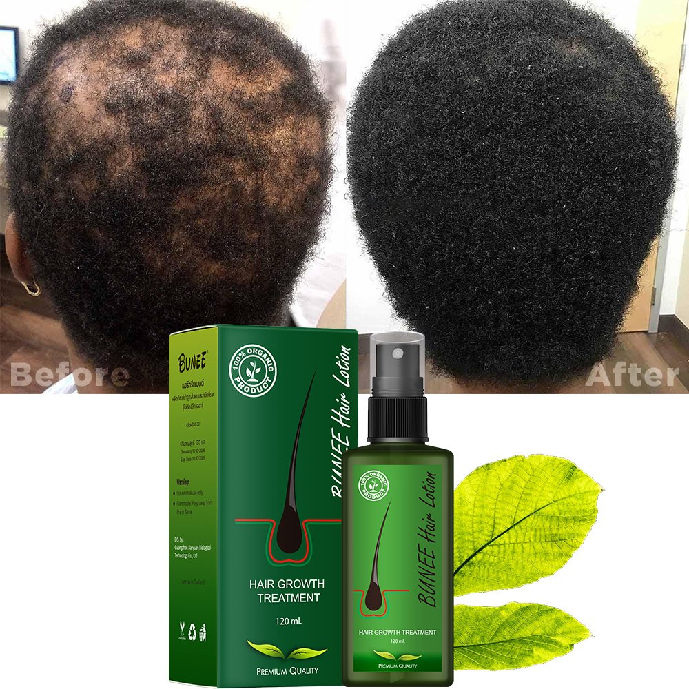 Hair loss regrowth treatments 120ml hair growth liquid scalp spray serum new bunee hair lotion thailand