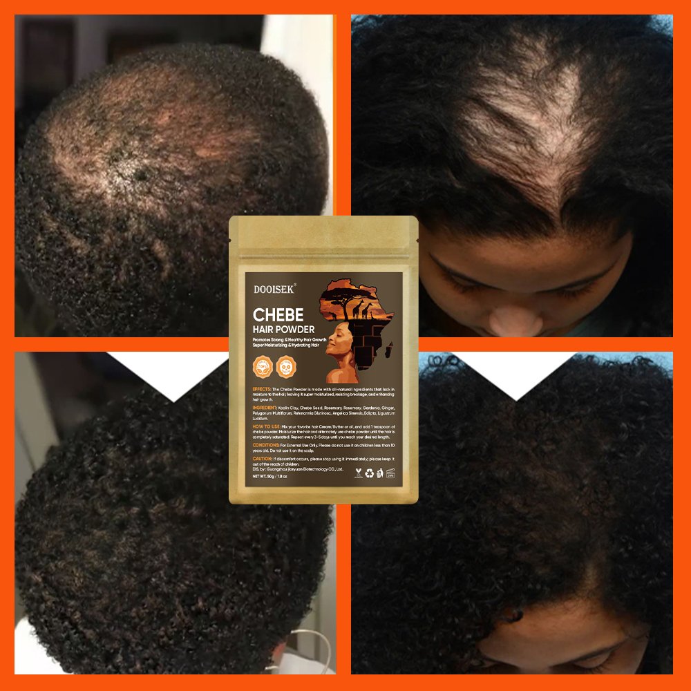 New Factory Chebe Hair Care Set Improve Hair Growth Alopeciae Hair Booster Growth Products From African Chebe Powder