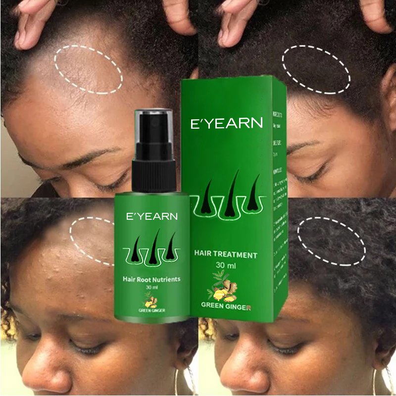 OEM Hair Growth Spray Caffeine Biotin Hair Loss Prevention Serum Stronger Fuller Hair Scalp Nourishing Spray Growth Tonic