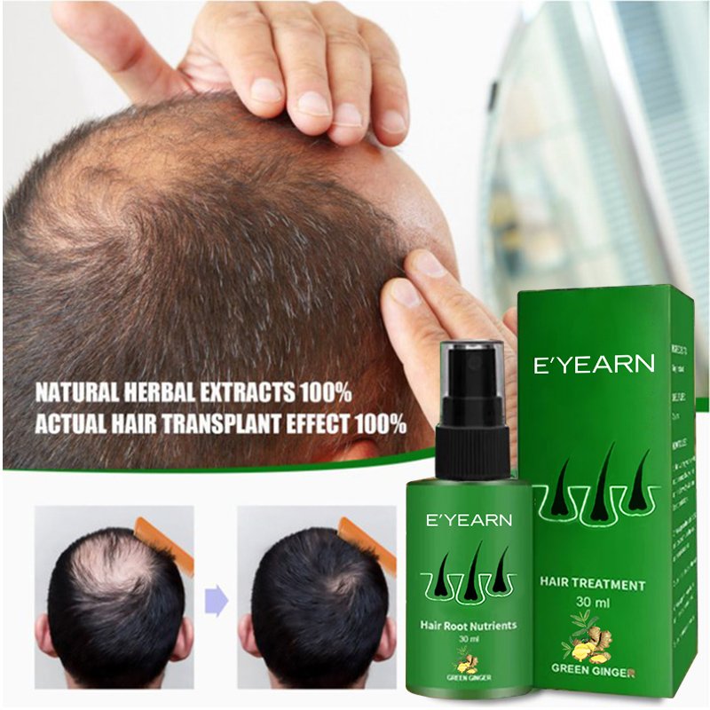 OEM Hair Growth Spray Caffeine Biotin Hair Loss Prevention Serum Stronger Fuller Hair Scalp Nourishing Spray Growth Tonic
