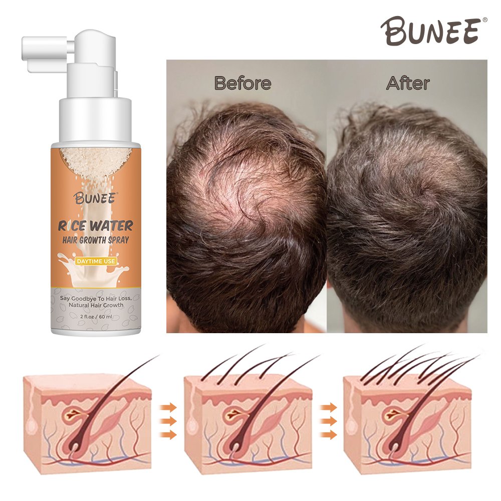 Best Sellers hair regrowth treatments Rice Water Hair Growth Serum Spray essential serum for hair honeysuckle essential oil