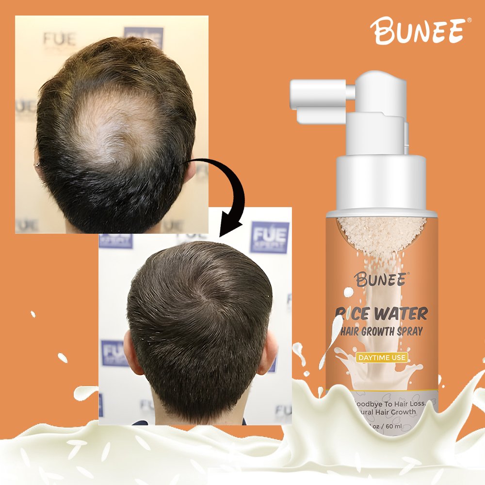 Best Sellers hair regrowth treatments Rice Water Hair Growth Serum Spray essential serum for hair honeysuckle essential oil