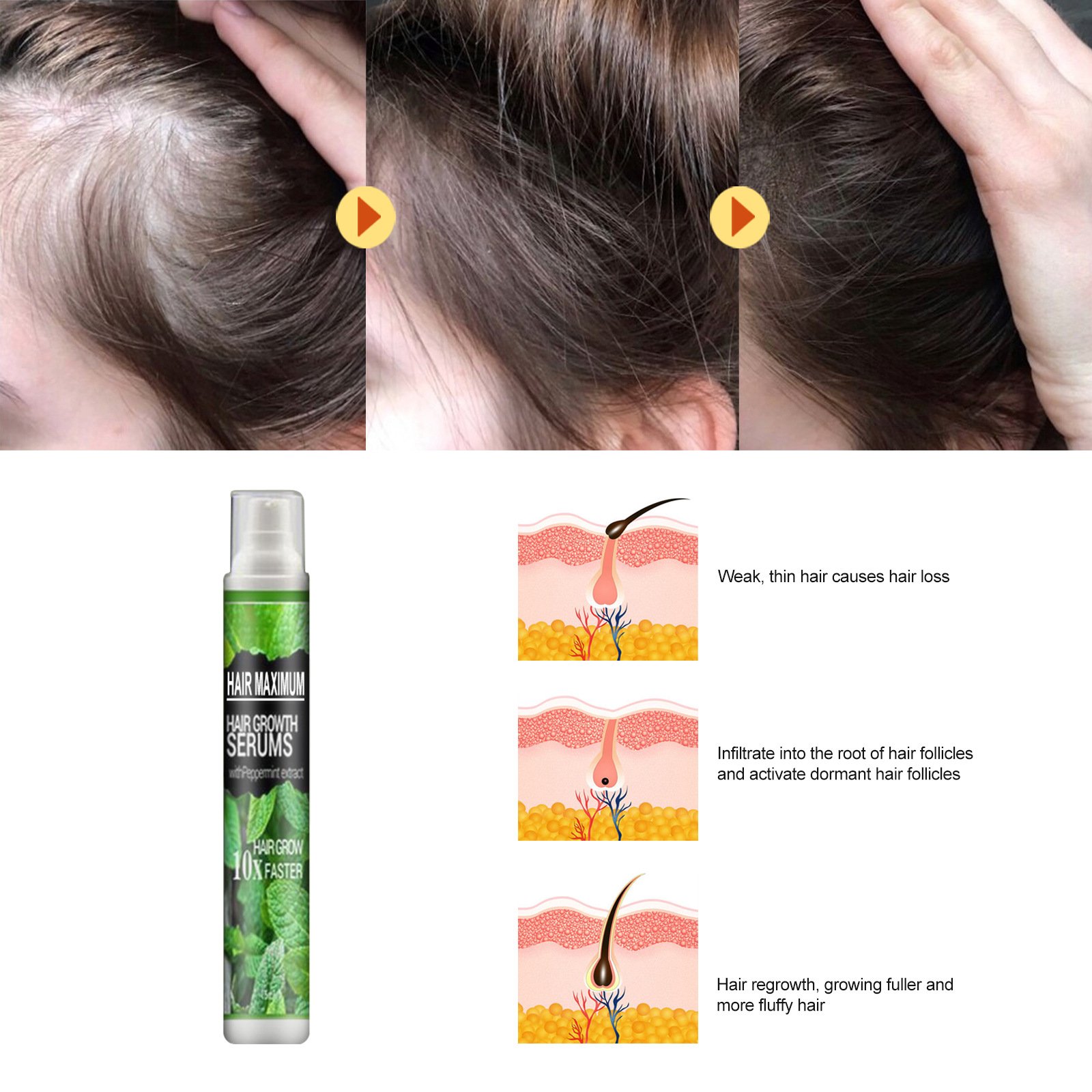 Hot Selling Herbal Instant Hair Growth Serum Organic Concentrated Oil for Daily Use Nourishing Hair Regrowth Wholesale