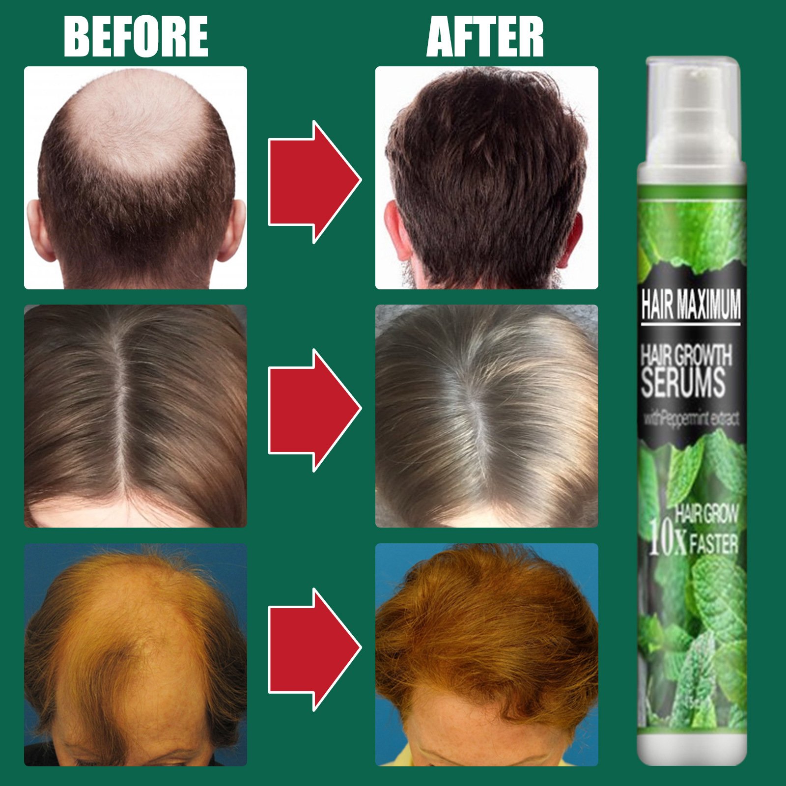 Hot Selling Herbal Instant Hair Growth Serum Organic Concentrated Oil for Daily Use Nourishing Hair Regrowth Wholesale