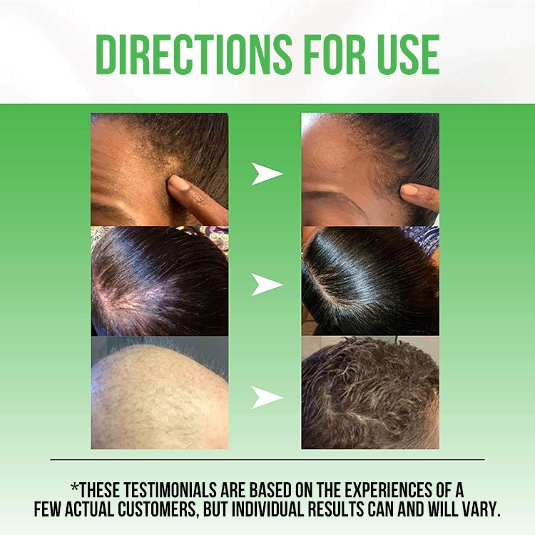 Hair Loss Treatment growth Oil Serum Growth Serum Treatment Hair Growth Products Reparators Hair Serum