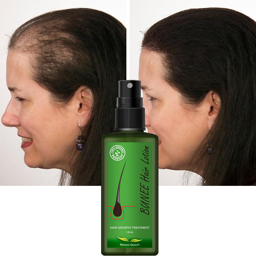 New Product Hair Lotion Hair Growth Spray Serum Lotion Scalp Strengthening Hair Growth Oil