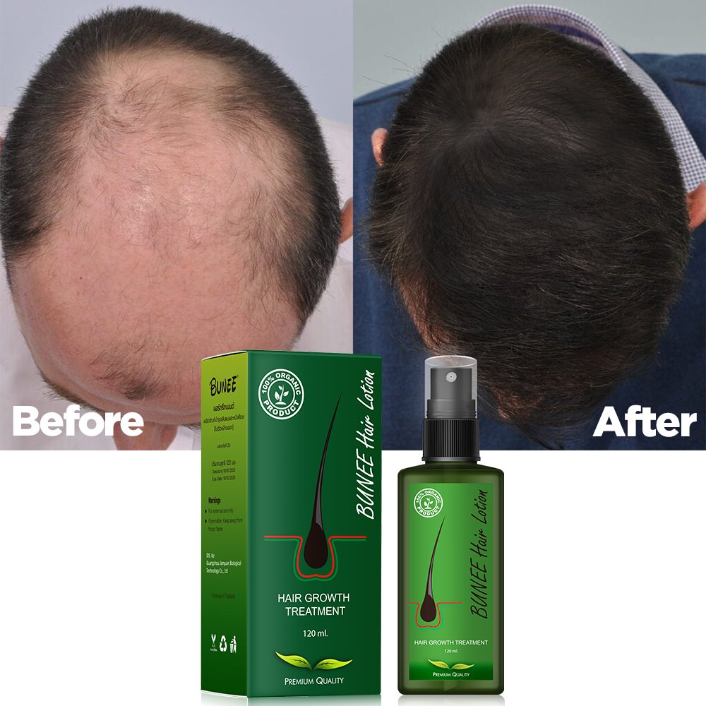 New Product Hair Lotion Hair Growth Spray Serum Lotion Scalp Strengthening Hair Growth Oil
