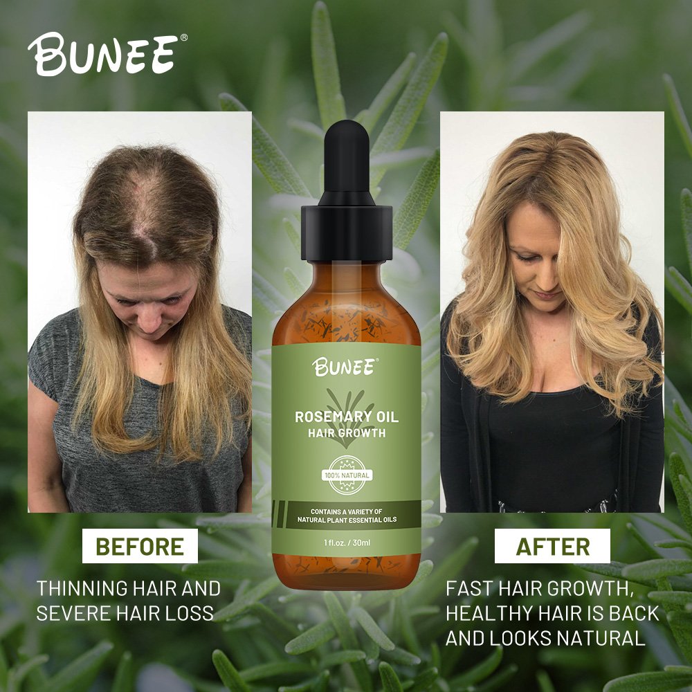 BUNEE Organic Ingredients fast Strengthen thin Hairline Rosemary oil Hair growth serum argon oil for all hair types 60/120ml